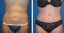 Before & After Photos